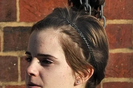 Эмма Уотсон без макияжа показала проблемную кожу