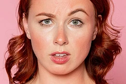 5 способов избавиться от покраснения кожи лица