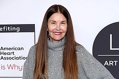 Дженис Дикинсон и её первый опыт пластической хирургии в 32 года