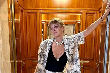 Шерон Стоун восстанавливается после травмы, полученной во время отдыха в Турции