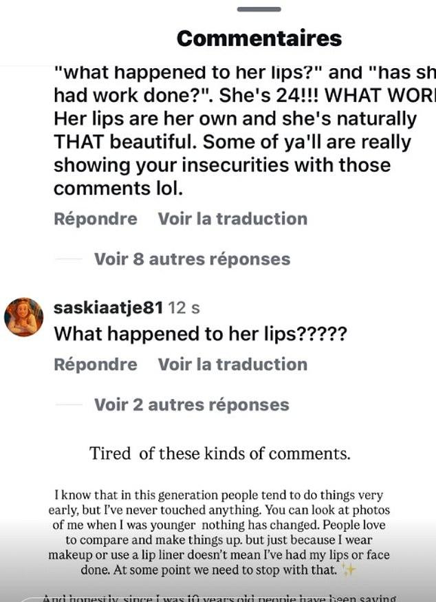 Но теперь в Instagram она показала онлайн-травлю за внешность.