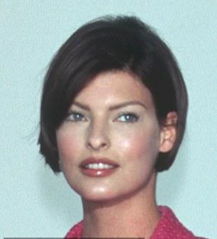 Модель на фото 1995 года пережила редкую реакцию на процедуру CoolSculpting.