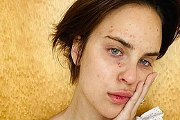 Дочь Деми Мур и Брюса Уиллиса Таллула раскрыла последствия своего расстройства, выражающегося в расцарапывании кожи