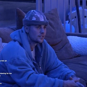 Джастин Бибер получил серьезную травму, упав с электрического скейтборда Onewheel