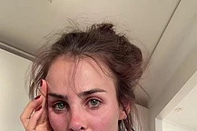 Инди Клинтон не сдержала слез, рассказав о предстоящей обширной операции по переделке носа