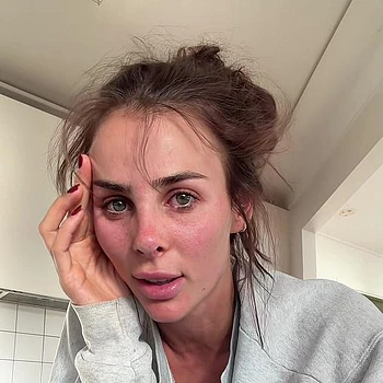 Инди Клинтон не сдержала слез, рассказав о предстоящей обширной операции по переделке носа