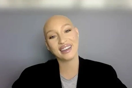 Выпускница шоу «Топ-модель по-американски» Джина Тёрнер заявляет, что Тайра Бэнкс и её команда ввели её в заблуждение перед скандальным преображением со сбриванием волос в 2018 году